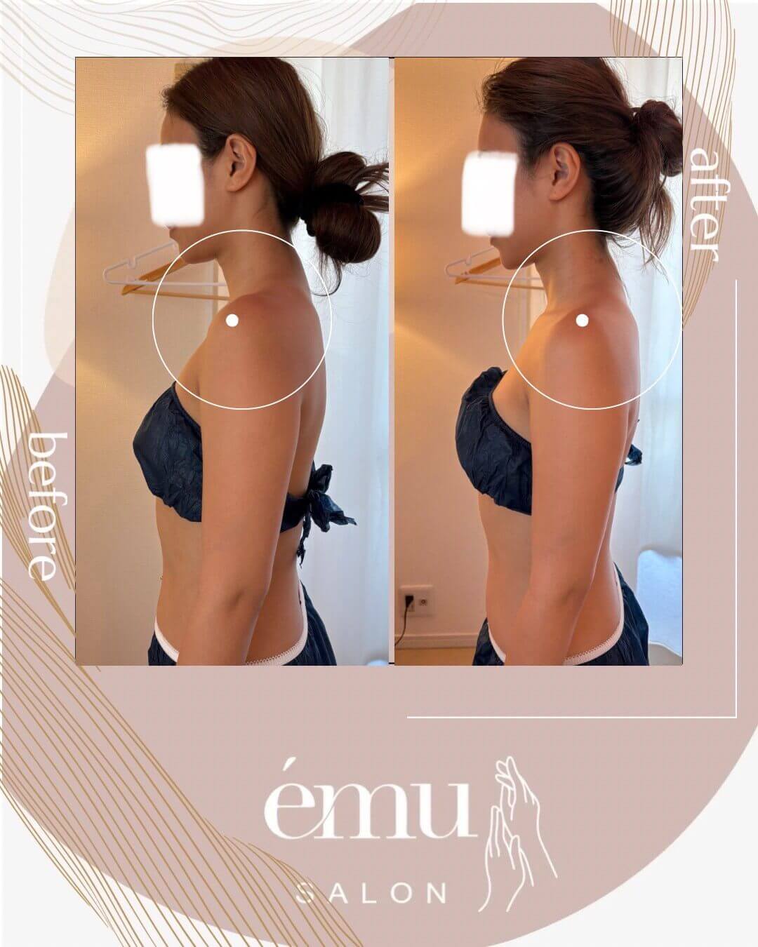 症例3｜深層リンパマッサージ